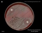 optochin test with pneumococcus